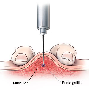 Un proveedor de atención médica aplicando una inyección a un hombre en la parte posterior del cuello.